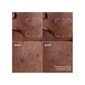 Miniatyrbild 5 av 6: Depigmenteringsserum - Even Better Clinical - UP302 - Känslig hud - 30 ml