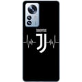 Pikkukuva 1 / 3: Yhteensopiva Puhelinkuori Xiaomi 12 Pro Juventus