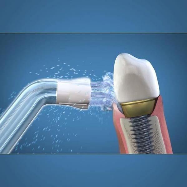 Waterpik Plaque Seeker Vandtandtrådsspids - Fjerner plak