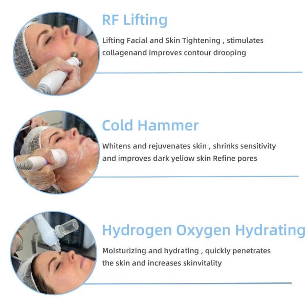 Oxygen Jet Peel Ansigtsmaskine, Hudstramning, Dyb Rensning, Fjernelse af Døde Hudceller