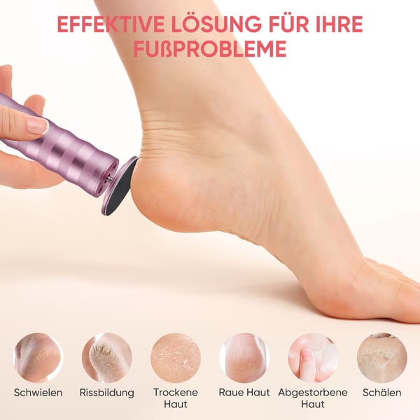 Elektrisk fodfil - Fodrasp - USB-genopladelig - Udskiftelig sliberulle - Fjerner hård hud & døde hudceller - Pedicure - Rød