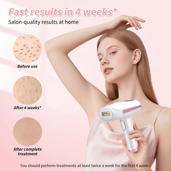 Hårfjerningsapparat - Laser Epilator - 9 Energiniveauer - 999.900 Lysimpulser - Genopladelig - Hurtig Opladning - Til Ansigt - Hvid