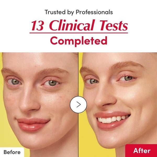 Serum - EQQUAL BERRY - Lysnende Serum - 30ML - Acérola 40% - Hypoallergen - Fugtighedsgivende