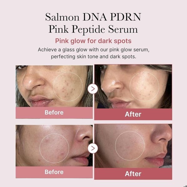 Serum - MEDICUBE - PDRN Pink Peptide Serum - 30ml - Rosenlys - Langvarig fugt - Mat hud