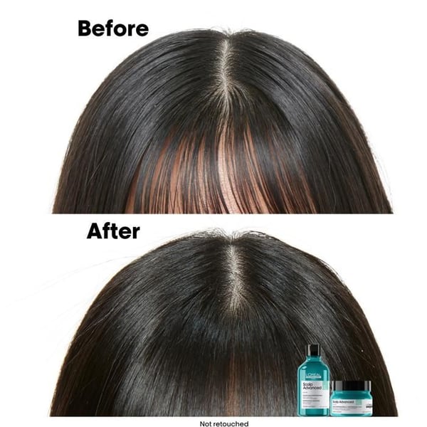 L'ORÉAL PROFESSIONNEL Serie Expert Scalp Advanced Anti-Oiliness 2-i-1 Lera 250 ml