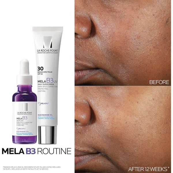 Anti-Flek Serum - LA ROCHE-POSAY - Mela B3 - 50 ml - Niacinamid 10% - Hypoallergenisk