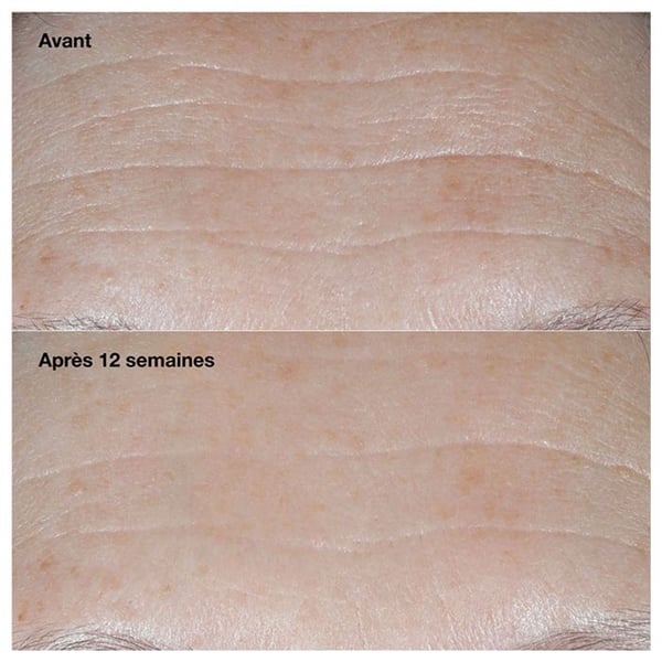 Korrigerande Kräm Mot Rynkor - CLINIQUE - Smart Clinical Repair - SPF30 - 50Ml - Hypoallergen
