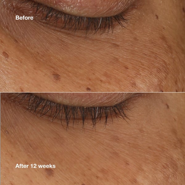 CLINIQUE_All About Eyes Brightening serum 10 ml