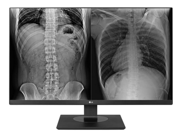 LG 27HJ713C-B Clinical Review Monitor - LED-skjerm - 8MP - farge - 27" - 3840 x 2160 4K - IPS - 350 cd/m² - 1000:1 - 14 ms - 2xHDMI, DisplayPort