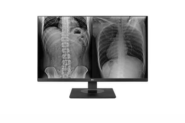 LG 27HJ713C-B Clinical Review Monitor - LED-skjerm - 8MP - farge - 27" - 3840 x 2160 4K - IPS - 350 cd/m² - 1000:1 - 14 ms - 2xHDMI, DisplayPort