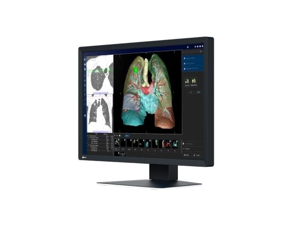 EIZO RadiForce MX243W, 61,2 cm (24,1"), 1920 x 1200 piksler, WUXGA, LCD, 22 ms, Sort