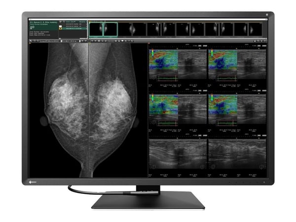 EIZO RadiForce RX1270, 78,7 cm (31"), 4200 x 2800 pikseliä, LCD, 12 ms, Musta, Valkoinen