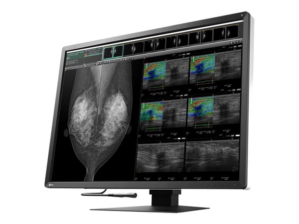 EIZO RadiForce RX1270, 78,7 cm (31"), 4200 x 2800 pikseliä, LCD, 12 ms, Musta, Valkoinen