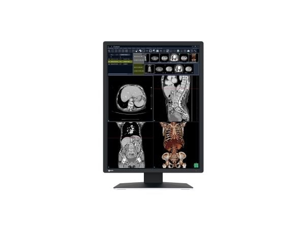 EIZO RadiForce RX270 - LCD-skjerm - 2MP - farge - 21.3" - 1200 x 1600 - IPS - 1000 cd/m² - 1800:1 - 20 ms - DVI-D, 2xDisplayPort - svart