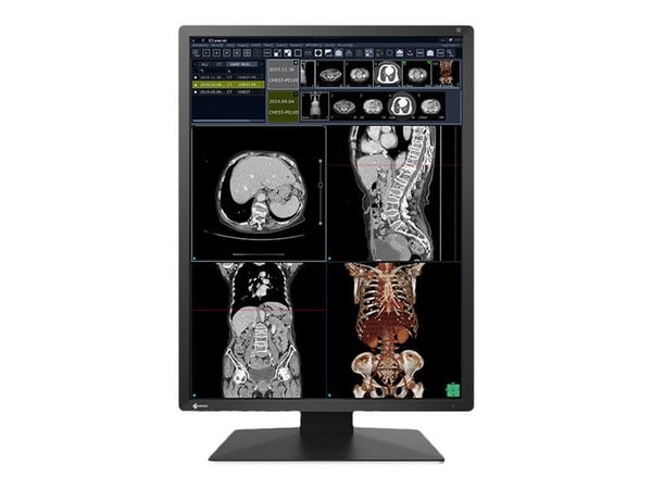 EIZO RadiForce RX270 - LCD-skjerm - 2MP - farge - 21.3" - 1200 x 1600 - IPS - 1000 cd/m² - 1800:1 - 20 ms - DVI-D, 2xDisplayPort - svart