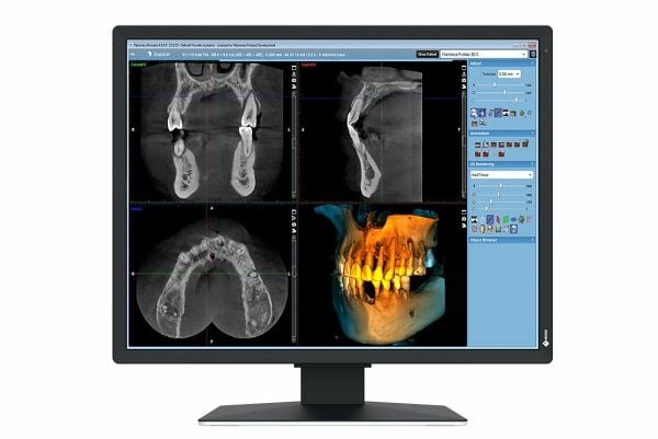 EIZO RadiForce MX217-SB - LED-skjerm - 2MP - farge - 21" - 1200 x 1600 - IPS - 500 cd/m² - 1800:1 - DVI-D, DisplayPort - svart