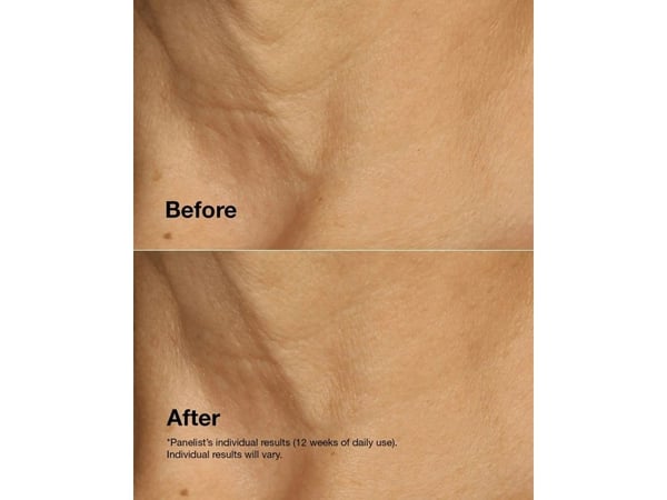 Clinique Smart Clinical Repair Lifting Face + Neck Cream - - 50 ml