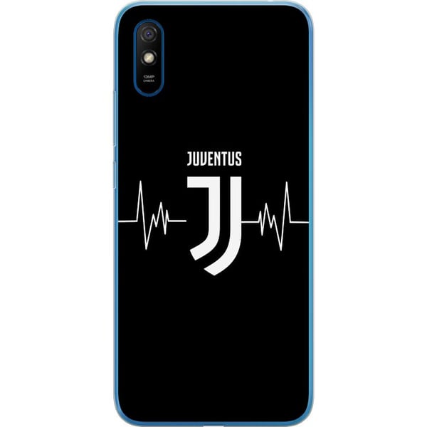 Kompatibel Mobilcover til Xiaomi Redmi 9A Juventus