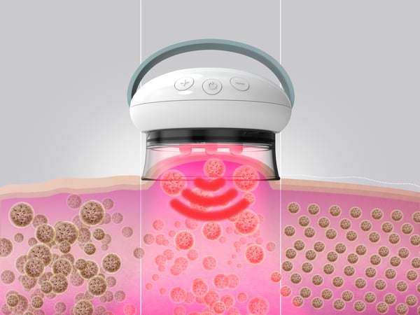 HoMedics Smoothee IR massageapparat Ben Hvid