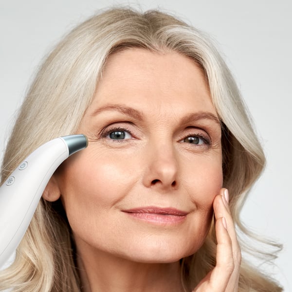 HoMedics MD-1000-EU2 hudvårdsapparater Hudvakuummikrodermabrasion Vit