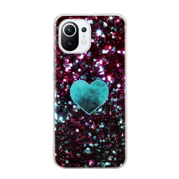 SKALO Xiaomi Mi 11 Lite Marmor TPU-cover - #3