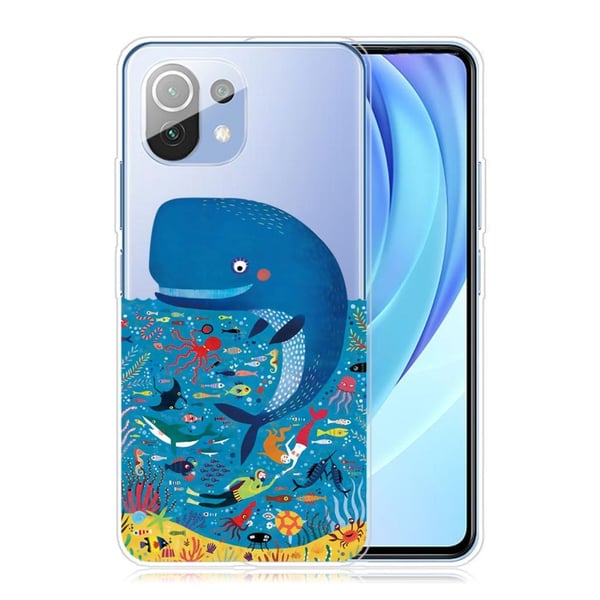 Deco Xiaomi Mi 11 Etui - Blå Hval