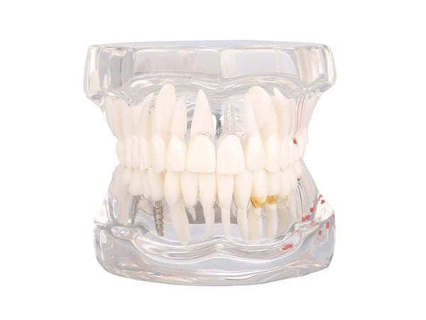 Anatomisk Tandmodell - Tandprotes - White
