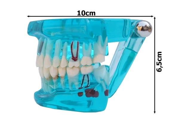 Anatomisk Tandmodell - Tandprotes - Blue