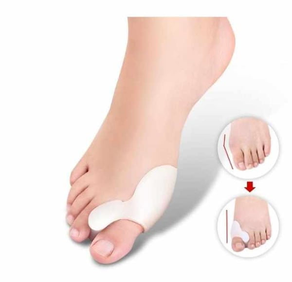 2-pack - Hallux Valgus - Isovarpaan levittäjä