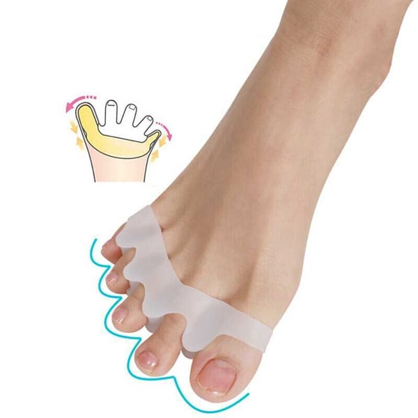 Hallux Valgus - viisi varvasta pitkä