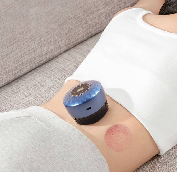 Elektronisk massageapparat til cupping-terapi - genopladeligt