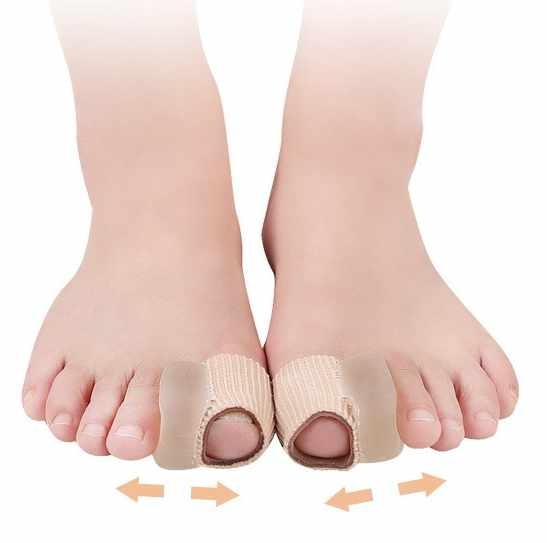 Hallux Valgus - Isovarpaan erotin