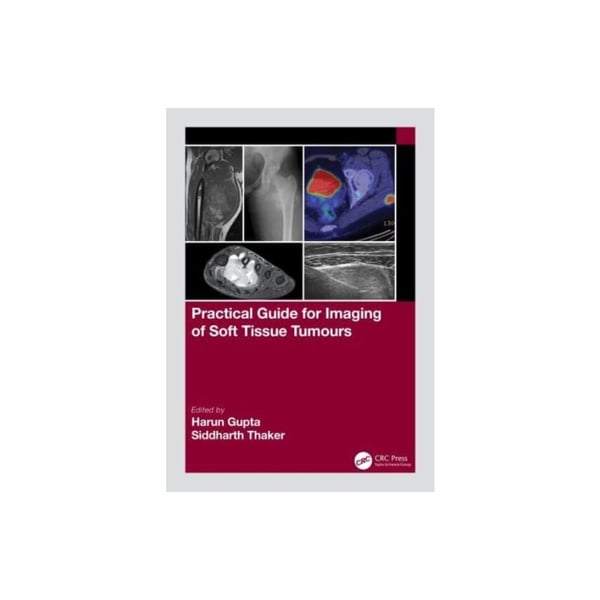 Practical Guide for Imaging of Soft Tissue Tumours (häftad, eng) | CDON