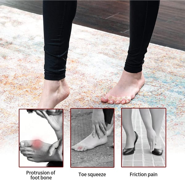 Tåskiller til Hallux valgus 1 par Beige
