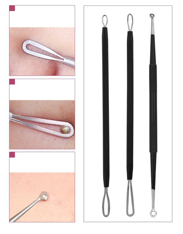 5 Pack Blackhead Remover Acne Needle Tools Kit Black