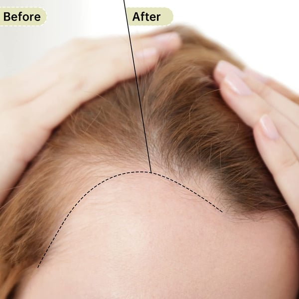 Tape for Hair Extensions Dobbeltsidig 1 rull Size B