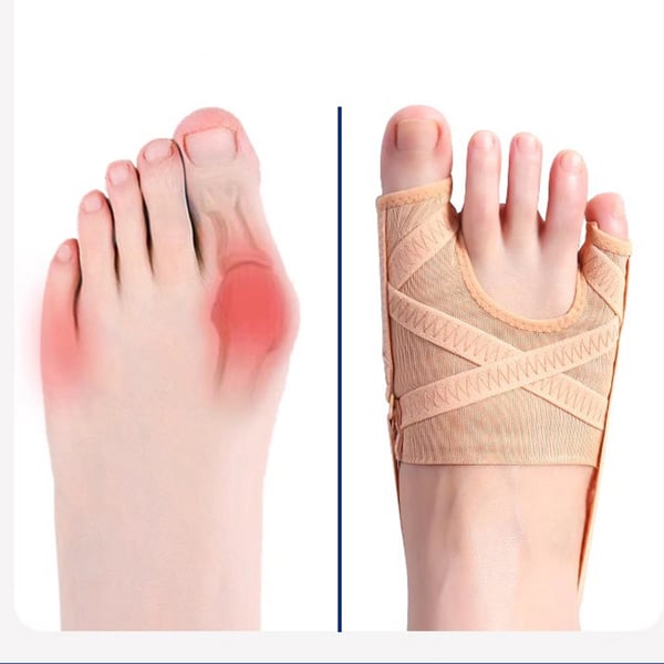 Pustende dobbelt tåskille for hallux valgus og overlappende tær M