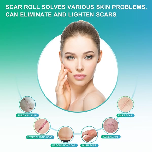 Ar Tape - Silikone Ar Ark Beige 3 m