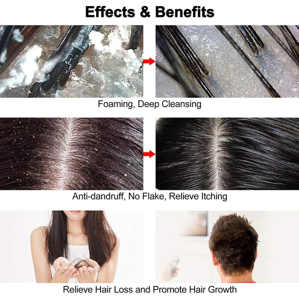 Børste til hovedbundsmassage og peeling Pink