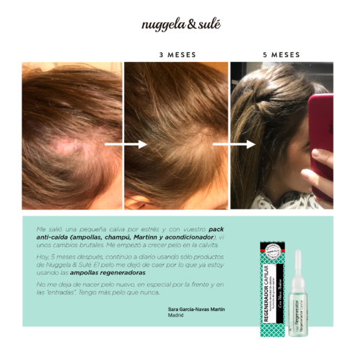Pikkukuva 2 / 3: Nuggela & Sulé 1401-61344 hiustenlähtö hoitotuote 10 ml Unisex