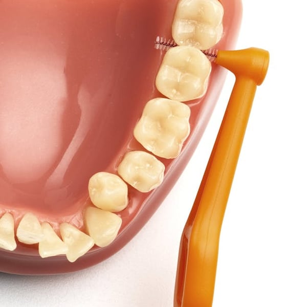 Miniatyrbillede 2 af 5: Tepe Angle