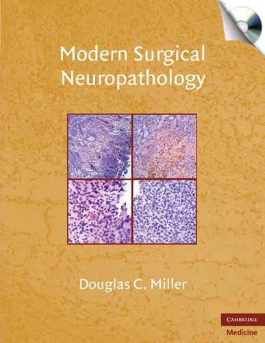 Moderne Kirurgisk Neuropatologi med CD-ROM