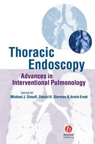 Thoraxendoskopia: Interventio pulmonologian edistysaskeleet
