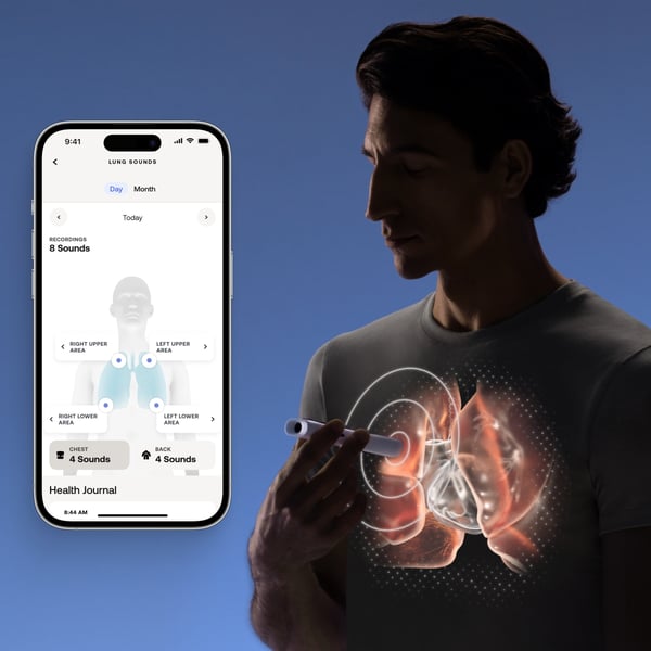 Withings BeamO 4-i-1 hälsövervakningsverktyg
