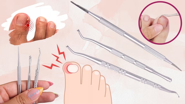 3-delt sæt til indadvendende neglepleje fodpleispecialist