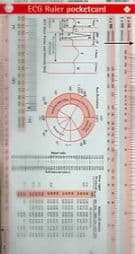 ECG Ruler Pocketcard