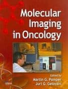 Molecular Imaging in Oncology