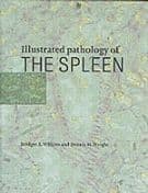 Illustrated Pathology of the Spleen