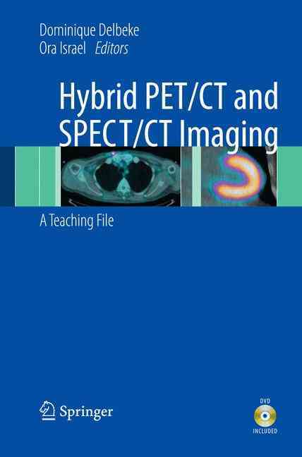 Hybrid PET/CT and SPECT/CT Imaging