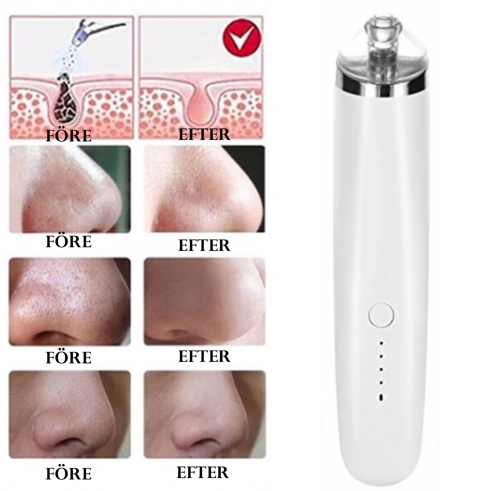 Blackhead remover PRO+ remover suger ut upp till 99% av alla pormaskar VIT USB